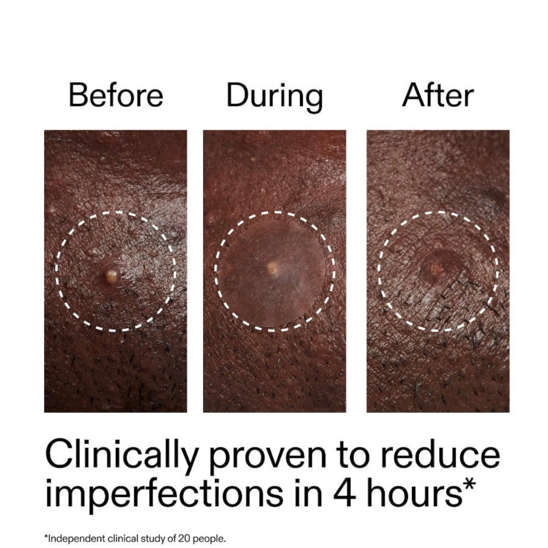 THE INKEY LIST | Target + Clarify Anti-Imperfections Kit
