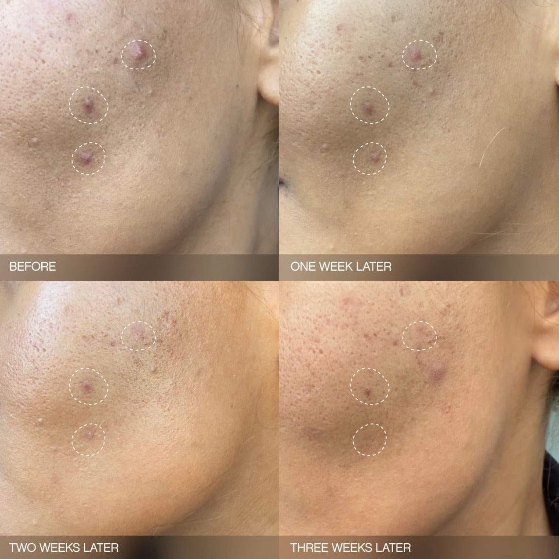 TOPICALS | Mini Faded Brightening Serum For Dark Spots (UNSCENTED)