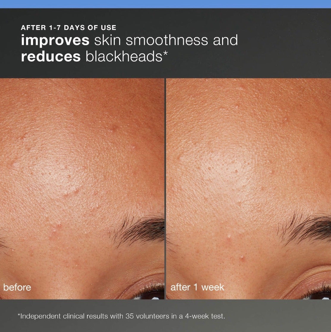 DERMALOGICA | Discover Healthy Skin Kit