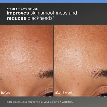 DERMALOGICA | Discover Healthy Skin Kit